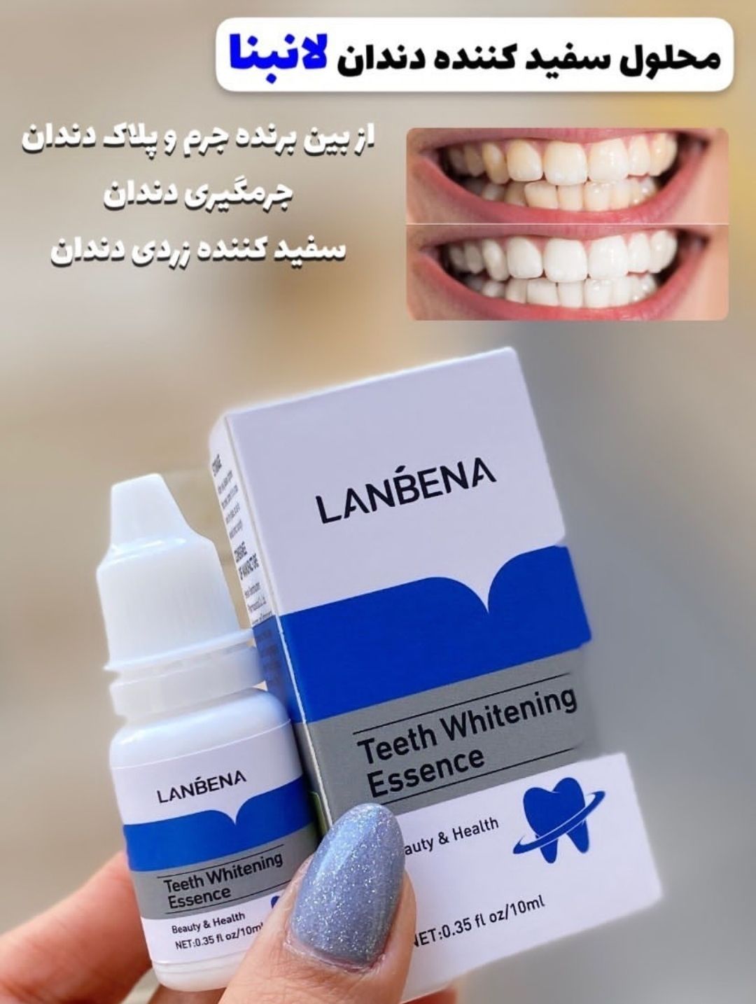 قطره سفید کننده از برند معروف لانبینا